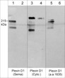 Western blot Plexin D1 expression in HUVEC cells with blocking peptide controls STJA0041350