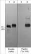Western blot A431 cells phospho-Paxillin Tyr-118 detection using antibody STJA0041354