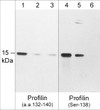 Western blot anti-Profilin phospho-specific antibody detection in Jurkat cells STJA0041357