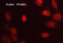 ICC staining Profilin in human NCI-H1915 lung carcinoma cells using antibody STJA0041358