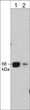 anti-A-Raf antibody Western blot analysis human Jurkat cell lysate at two dilutions STJA0041361