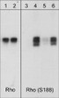Western blot analysis RhoA phosphorylation using anti-RhoA Ser-188 antibody STJA0041362