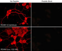 ICC staining RCAN1 in NGF-differentiated PC12 cells using antibody with blocking peptide control STJA0041369