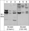 Western blot RCAN1 expression in JurkatC2C12and PC12 cells using antibody STJA0041370