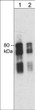 anti-Synapsin I antibody Western blot mouse brain lysate at two dilutions STJA0041382
