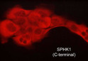 ICC staining SPHK1 in A431 cells using rat monoclonal antibody with DyLight 594 STJA0041387