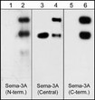 Western blot anti-Sema3A antibody detecting 95 kDa and 125 kDa bands in rat brain tissue STJA0041391