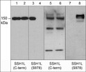 Western blot SSH1L protein in human recombinant and rat PC12 cell lysates STJA0041400