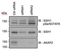 Western blot detection Phospho-SSH1 using antibody in DU-145 cells with siRNA knockdown STJA0041402