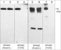 Western blot anti-SK2 antibody detection in recombinant SK2 and HeLa cell lysates STJA0041406