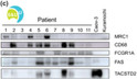 Western blot TACSTD2 detection in HGSC EV fractions and cell line controls STJA0041415