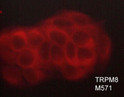 ICC staining TRPM8 in MCF-7 cells using mouse monoclonal antibody with DyLight 594 STJA0041419