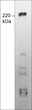 Western blot TRPM7 expression in MCF-7 cells using antibody STJA0041421