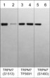 Western blot TRPM7 phosphorylation detection using antibody with phosphatase treatment controls STJA0041431
