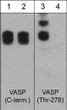 WB analysis A431 cells VASP phosphorylation with phosphatase treatment comparison STJA0041436