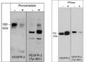 Western blot analysis VEGFR-2 phosphorylation in HUVEC cells using antibody STJA0041445