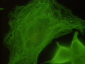 Tubulin beta antibody immunocytochemistry HeLa cells STJA0032398