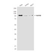 NUP98 antibody western blot HeLa Jurkat MCF-7 STJA0032402