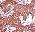 AMPK beta 1 antibody immunohistochemistry breast cancer STJA0032433