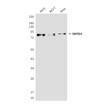 SMYD4 antibody western blot HeLa MCF-7 A431 STJA0032445