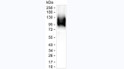 beta Amyloid 1-42 antibody western blot synthetic APP peptide STJA0032595