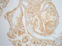 Galectin 3 antibody immunohistochemistry human thyroid tissue STJA0032765