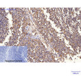 HER2 antibody immunohistochemistry human tonsil tissue STJA0032766