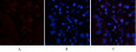 CD45 antibody immunofluorescence human liver cancer tissue STJA0032767