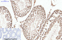 Progesterone Receptor antibody immunohistochemistry human tonsils STJA0032815