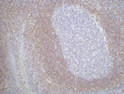 Bcl2 antibody immunohistochemistry human tonsil tissue STJA0032877