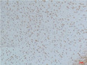 Phospho-CaMKII antibody immunohistochemistry human tonsils STJA0032884