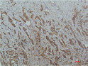 HDAC1 antibody immunohistochemistry human tonsils STJA0032893