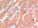 epsilon Tubulin antibody immunohistochemistry human tonsils STJA0032919