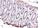 HP1 gamma antibody immunohistochemistry human colon carcinoma STJA0032935