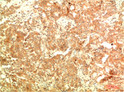 APG5L antibody immunohistochemistry human tonsils STJA0032943
