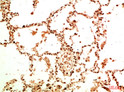 Acetyl-NF-KB p65 antibody immunohistochemistry human tonsils STJA0032945