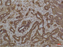GRP78 BiP antibody immunohistochemistry human tonsils STJA0032968