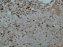 Galectin 3 antibody immunohistochemistry human tonsils STJA0032978