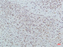 PPAR delta antibody immunohistochemistry human tonsils STJA0032982