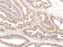 STAT1 antibody immunohistochemistry human colon tissue STJA0032983