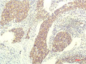 STAT1 antibody immunohistochemistry human tonsils STJA0032985