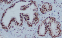 HP1 gamma antibody immunohistochemistry prostate cancer tissue STJA0033180