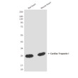 Cardiac Troponin I antibody western blot rat mouse heart STJA0033265