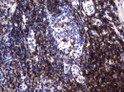 CD2 antibody immunohistochemistry human tonsil STJA0033306