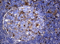 Thymidine Phosphorylase antibody immunohistochemistry human lymph node STJA0033311
