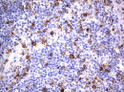 CD80 antibody immunohistochemistry human lymphoma tissue STJA0033333