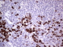 GLI1 antibody immunohistochemistry human tonsil STJA0033341
