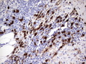 S100 alpha9 antibody immunohistochemistry human lymph node STJA0033344
