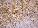 Galectin 3 antibody immunohistochemistry human lymph node STJA0033359