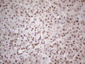 MLH1 antibody immunohistochemistry human pancreas tissue STJA0033361